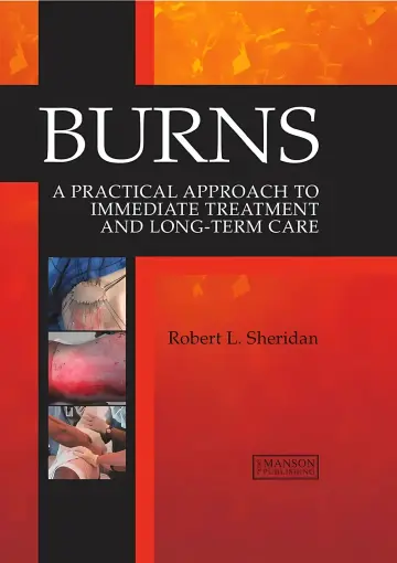 Cover of Burns a Practical Approach