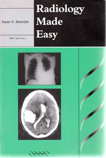 Cover of Radiology Made Easy
