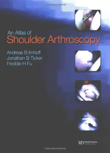 Cover of Atlas of Shoulder Arthroscopy