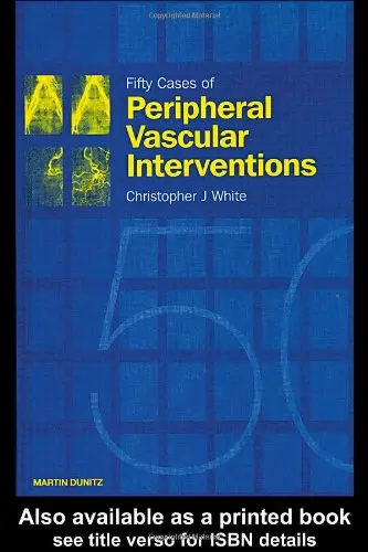 Cover of Fifty Cases of Peripheral Vascular Interventions