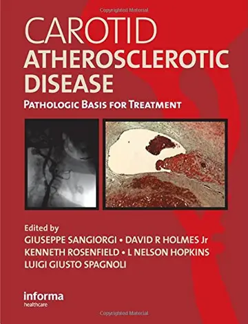 Cover of Carotid Atherosclerotic Disease