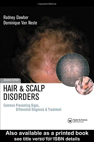 Cover of Hair and Scalp Disorders