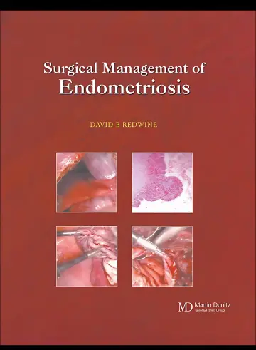 Cover of Surgical management of endometriosis