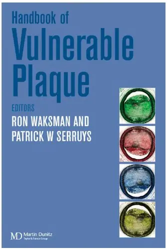 Cover of Handbook of the Vulnerable Plaque