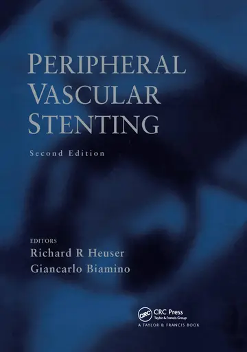 Cover of Peripheral Vascular Stenting