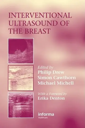 Cover of Interventional Ultrasound of the Breast
