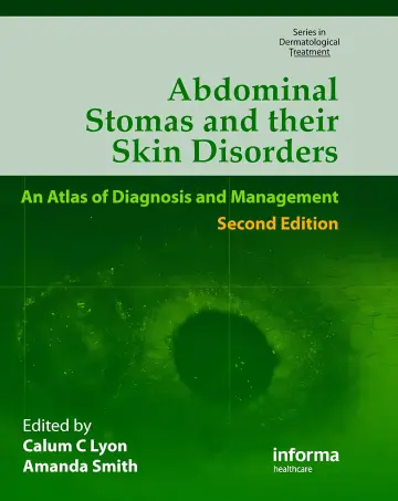 Cover of Abdominal Stomas and Their Skin Disorders