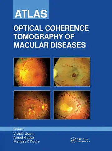 Cover of (Org)Atlas of Optical Coherence Tomography of Macular Diseases, 1/Ed