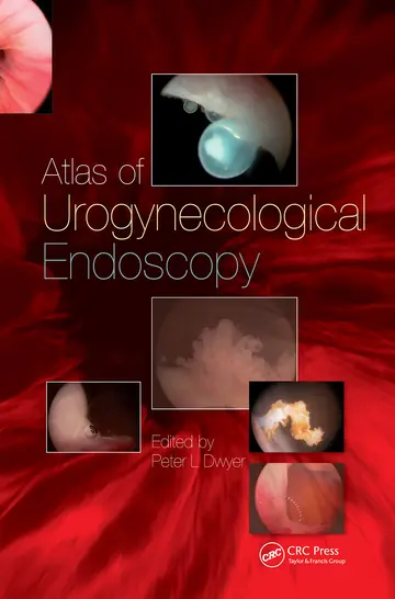 Cover of Handbook of Urologic Cryoablation