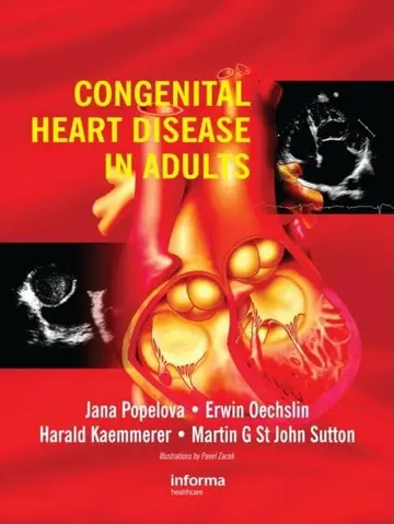 Cover of Congenital Heart Disease in Adults