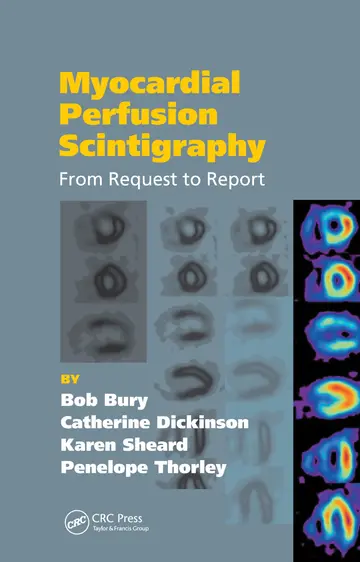 Cover of Myocardial Perfusion Scintigraphy