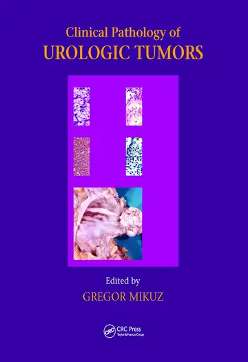 Cover of Clinical Pathology of Urological Tumours