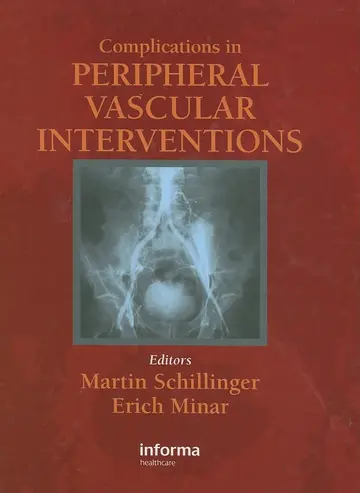 Cover of Complications in Peripheral Vascular Interventions