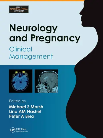 Cover of Neurology & Pregnancy