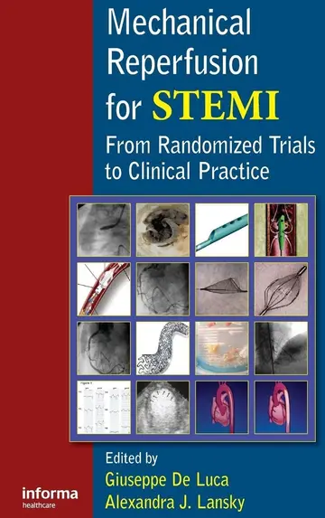Cover of Mechanical Reperfusion for STEMI