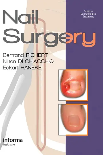 Cover of Nail Surgery