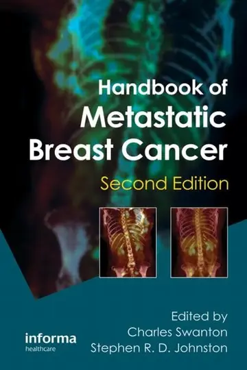 Cover of Handbook of Metastatic Breast Cancer
