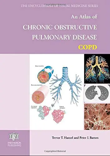 Cover of An Atlas of Chronic Obstructive Pulmonary Disease