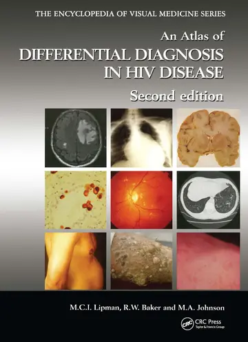 Cover of Atlas of Differential Diagnosis in HIV Disease