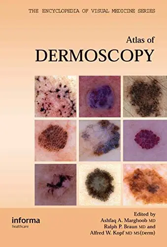 Cover of An Atlas of Dermoscopy