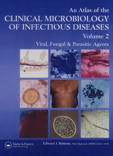 Cover of An Atlas of Clinical Microbiology of Infectious Diseases Vol.2