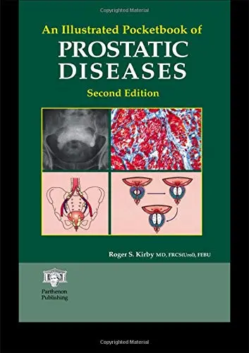 Cover of An Illustrated Pocketbook of Prostatic Disease