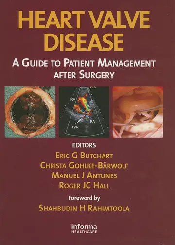 Cover of Heart Valve Disease