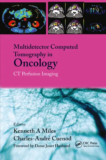 Cover of Multidetector Computed Tomography in Oncology CT Perfusion Imaging