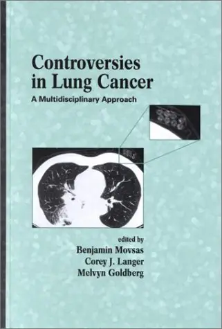 Cover of Controversies in Lung Cancer