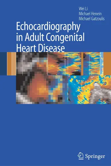 Cover of Echocardiography in Adult Congenital Heart Disease