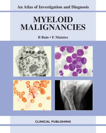 Cover of Myeloid Malignancies