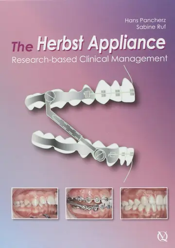 Cover of The Herbst Appliance Research Based Clinical Management