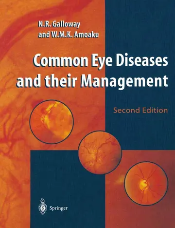 Cover of Common Eye Diseases and Their Management
