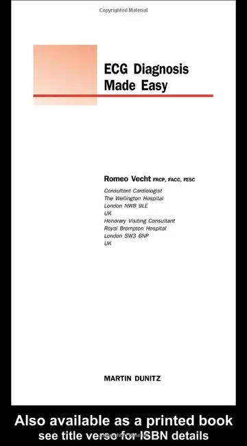 Cover of (Ex)Ecg Diagnosis Made Easy with Cd
