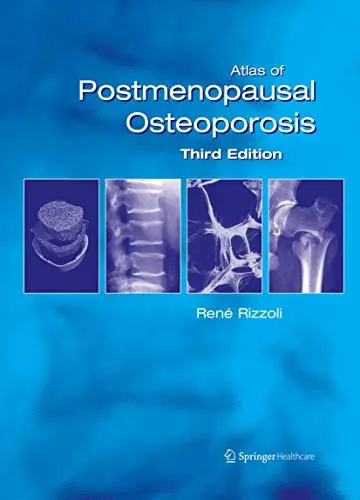 Cover of Atlas of Postmenopausal Osteoporosis