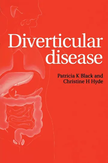 Cover of Diverticular Disease