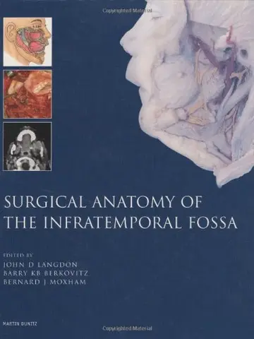 Cover of Surgical Management of the Infratemporal Fossa