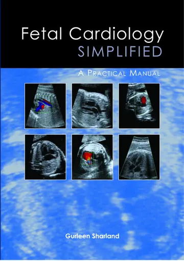 Cover of Fetal Cardiology Simplified