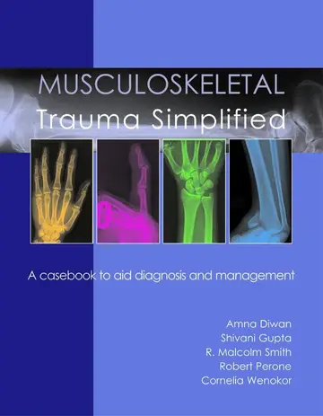 Cover of Musculoskeletal Trauma Simplified (1998)