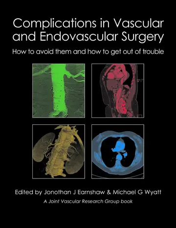 Cover of Complications in Vascular & Endovascular Surgery