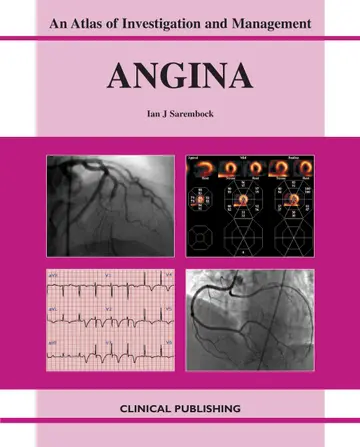 Cover of Angina