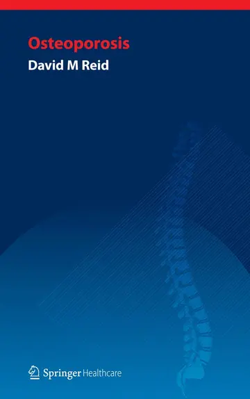 Cover of Handbook of Osteoporosis