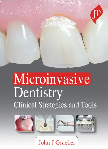 Cover of Microinvasive Dentistry