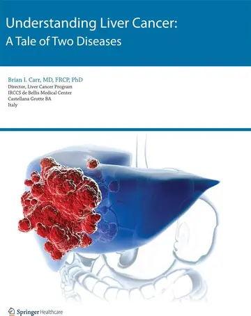 Cover of Understanding Liver Cancer