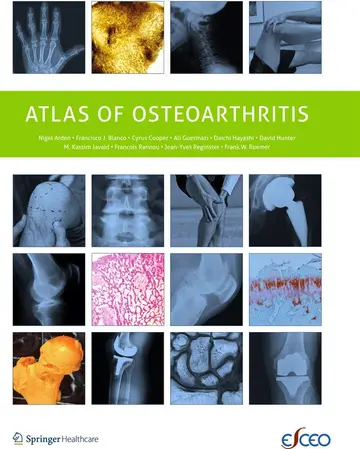 Cover of Atlas of Osteoarthritis