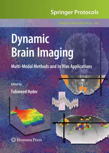 Cover of Dynamic Brain Imaging