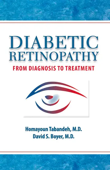 Cover of Diabetic Retinopathy