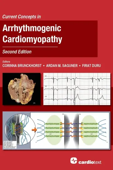 Cover of Current Concepts in Arrhythmogenic Cardiomyopathy, Second Edition