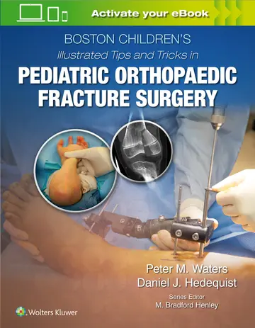 Cover of Boston Childrens Illustrated Tips and Tricks in Pediatric Orthopaedic Fracture Surgery