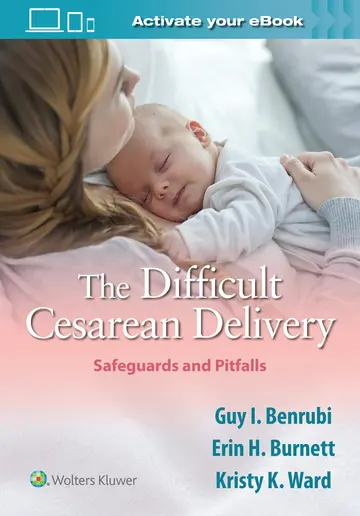Cover of The Difficult Cesarean Delivery Safeguards and Pitfalls